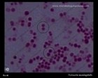 culture of Neisseria meningitidis on agar plate